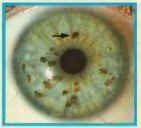 eye1.bmp (54326 bytes)